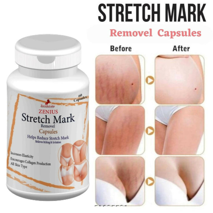 Zenius stretch mark removal capsule for all age group | 60 Capsules