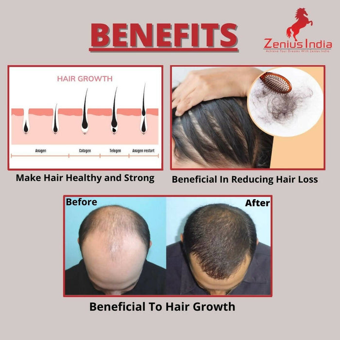 Zenius Hair Oil for hair growth, hair dandruff removal oil | 200ml oil