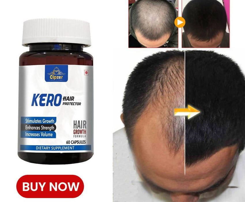 CIPZER Kero Hair Protector Capsule Prevents Hairfall And Supports Healthy Growth Of Hair- Hair Fall, Damage Repair, Anti-dandruff, Shinning In Men & Women Enriched With Ayurvedic Ingredients- ( Pack of 3) ( Prescription Not Required )